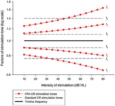 Adapted Acoustic CR Neuromodulation in Patients With Chronic Tonal Tinnitus and Hearing Loss